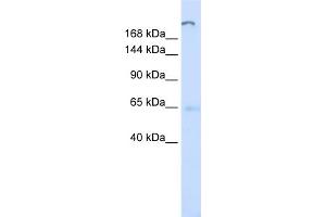 WB Suggested Anti-ATP10D Antibody Titration:  0. (ATP10D anticorps  (C-Term))