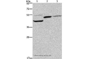 Western blot analysis of Mouse heart, kidney and liver tissue, using CYR61 Polyclonal Antibody at dilution of 1:350 (CYR61 anticorps)