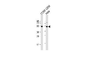 All lanes : Anti-TBB1 Antibody at 1:2000 dilution Lane 1: CCRF-CEM whole cell lysate Lane 2: Hela whole cell lysate Lysates/proteins at 20 μg per lane. (TUBB1 anticorps)