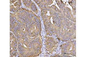 IHC analysis of MRPS22 using anti-MRPS22 antibody (ABIN7600613). (MRPS22 anticorps  (AA 21-329))