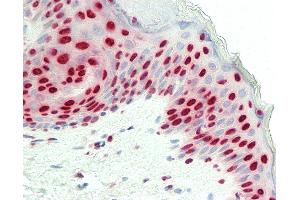 Anti-MATR3 / Matrin 3 antibody IHC staining of human skin.