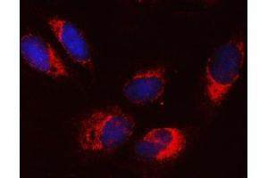 IF analysis of SRPRA using anti-SRPRA antibody (ABIN7601408). (SRPRA (AA 346-638) anticorps)