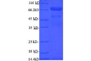 SDS-PAGE (SDS) image for TNF Receptor-Associated Factor 6 (TRAF6) (AA 1-522), (full length) protein (His-SUMO Tag) (ABIN5710550)