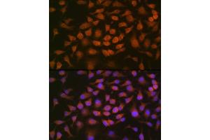 Immunofluorescence analysis of HeLa cells using GRK2 Rabbit mAb (ABIN7265504) at dilution of 1:100 (40x lens). (GRK2 anticorps)