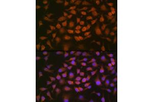 Immunofluorescence analysis of HeLa cells using GRK2 Rabbit mAb (ABIN7265504) at dilution of 1:100 (40x lens).