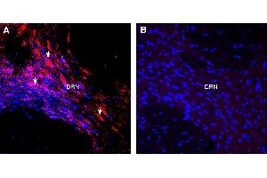 Expression of Orexin Receptor 1 in rat dorsal root nucleus (DRN). (Hypocretin (Orexin) Receptor 1 (HCRTR1) Peptide)