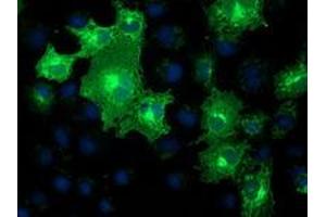 Immunofluorescence (IF) image for anti-Methylmalonic Aciduria (Cobalamin Deficiency) CblB Type (MMAB) antibody (ABIN1499509) (MMAB anticorps)