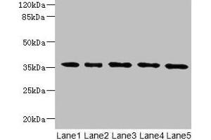 Western blot All lanes: OXNAD1 antibody at 4 μg/mL Lane 1: Mouse large intestine tissue Lane 2: Mouse lung tissue Lane 3: K562 whole cell lysate Lane 4: U251 whole cell lysate Lane 5: A549 whole cell lysate Secondary Goat polyclonal to rabbit IgG at 1/10000 dilution Predicted band size: 35 kDa Observed band size: 35 kDa (OXNAD1 anticorps  (AA 18-312))