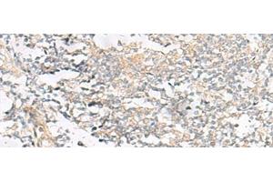 Immunohistochemistry of paraffin-embedded Human tonsil tissue using HELT Polyclonal Antibody at dilution of 1:40(x200) (HELT anticorps)