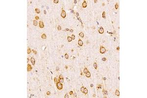 Immunohistochemistry analysis of paraffin-embedded human placenta using,CLIC6 (ABIN7073478) at dilution of 1: 600 (CLIC6 anticorps)