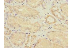 Immunohistochemistry of paraffin-embedded human kidney tissue using ABIN7171008 at dilution of 1:100 (SOCS6 anticorps  (AA 1-210))