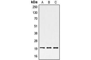 Western blot analysis of SRSF3 expression in HepG2 (A), HeLa (B), BJAB (C) whole cell lysates. (SRSF3 anticorps  (C-Term))