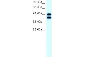 WB Suggested Anti-ACAT2 Antibody Titration:  2. (ACAT2 anticorps  (Middle Region))