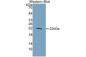 Western blot analysis of the recombinant protein. (GCKR anticorps  (AA 320-499))