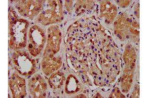 IHC image of ABIN7163794 diluted at 1:400 and staining in paraffin-embedded human kidney tissue performed on a Leica BondTM system.