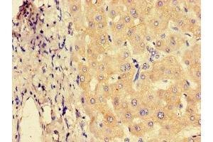 Immunohistochemistry of paraffin-embedded human liver tissue using ABIN7151230 at dilution of 1:100 (SYVN1 anticorps  (AA 338-487))