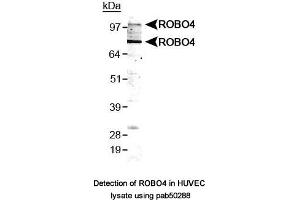 Image no. 1 for anti-Roundabout, Axon Guidance Receptor, Homolog 4 (ROBO4) (AA 200-300), (Internal Region) antibody (ABIN363597) (ROBO4 anticorps  (Internal Region))