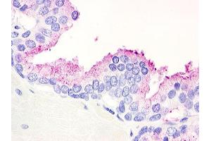 Anti-GPR21 antibody IHC of human prostate. (GPR21 anticorps  (Cytoplasmic Domain))