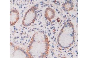 #VALUE! (CALY anticorps  (AA 1-63))