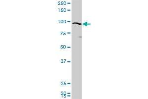 KIAA0317 polyclonal antibody (A01), Lot # 060807QCS1. (AREL1 anticorps  (AA 24-123))