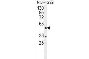 Western Blotting (WB) image for anti-Tripartite Motif Containing 72 (TRIM72) antibody (ABIN2996476) (TRIM72 anticorps)
