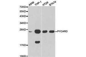 Western Blotting (WB) image for anti-Steroid Sulfatase (STS) antibody (ABIN1874484) (STS anticorps)