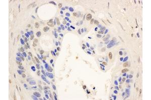 Immunohistochemistry (IHC) image for anti-Signal Transducer and Activator of Transcription 6, Interleukin-4 Induced (STAT6) (AA 600-650) antibody (ABIN7454626)