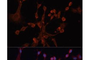 Immunofluorescence analysis of NIH/3T3 cells using GNA14 Polyclonal Antibody at dilution of 1:100.