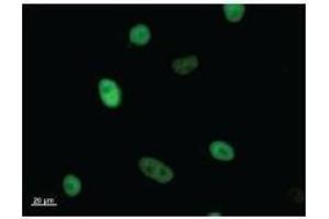 Immunostaining analysis in HeLa cells.