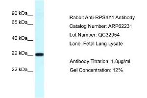 Western Blotting (WB) image for anti-Ribosomal Protein S4, Y-Linked 1 (RPS4Y1) (C-Term) antibody (ABIN2789074) (RPS4Y1 anticorps  (C-Term))
