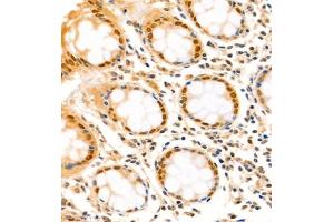 Immunohistochemistry analysis of paraffin-embedded human colon using,SATB2 (ABIN7075514) at dilution of 1: 1500 (SATB2 anticorps)