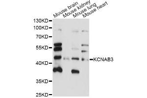 Western blot analysis of extracts of various cell lines, using KCNAB3 antibody (ABIN6292719) at 1:1000 dilution.