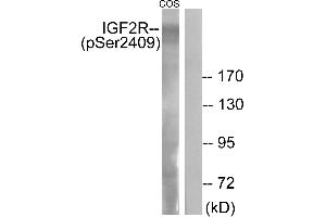 Western blot analysis of extracts from COS-7 cells, treated with UV (15 mins), using IGF2R (Phospho-Ser2409) antibody. (IGF2R anticorps  (pSer2409))