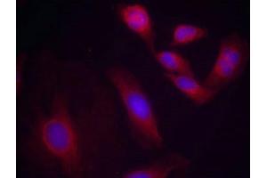Immunofluorescence staining of methanol-fixed Hela cells using NFkB-p65(Phospho-Ser536) Antibody.