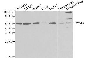 Western blot analysis of extracts of various cell lines, using WASL antibody (ABIN5971401) at 1/1000 dilution. (Neural Wiskott-Aldrich syndrome protein (WASL) anticorps)