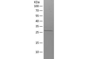 Western Blotting (WB) image for Glutamate Receptor, Ionotropic, N-Methyl D-Aspartate 2B (GRIN2B) (AA 1276-1484) protein (His tag) (ABIN7123110)