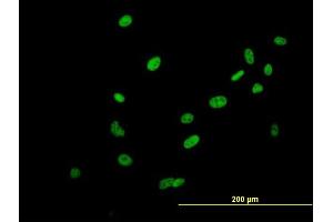 Immunofluorescence of purified MaxPab antibody to SAFB2 on HeLa cell. (SAFB2 anticorps  (AA 1-528))