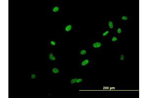 Immunofluorescence of purified MaxPab antibody to SAFB2 on HeLa cell. (SAFB2 anticorps  (AA 1-528))