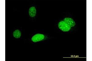 Immunofluorescence of monoclonal antibody to AURKB on HeLa cell. (Aurora Kinase B anticorps  (AA 1-90))