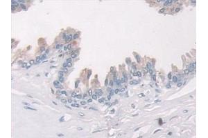 Detection of PAI1 in Human Prostate Tissue using Monoclonal Antibody to Plasminogen Activator Inhibitor 1 (PAI1)