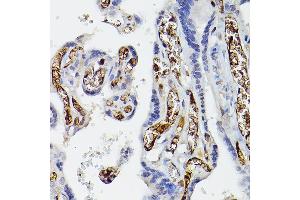 Immunohistochemistry of paraffin-embedded human placenta using APOE Rabbit pAb (ABIN6133561, ABIN6137017, ABIN6137019 and ABIN6213793) at dilution of 1:50 (40x lens). (APOE anticorps  (AA 200-300))
