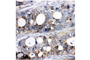 IHC analysis of Stathmin 1 using anti-Stathmin 1 antibody (ABIN3043301). (Stathmin 1 anticorps  (N-Term))