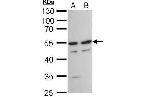 WB Image TAF7 antibody detects TAF7 protein by western blot analysis. (TAF7 anticorps  (Center))
