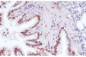Immunohistochemistry of paraffin-embedded Rat lung using Acetyl-Histone H3-K9/K14/K18/K23/K27 Polyclonal Antibody at dilution of 1:100 (40x lens).