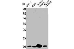 Western Blot analysis of MCF7 U251 mouse liver mouse kidney cells using ACBP Polyclonal Antibody (Diazepam Binding Inhibitor anticorps  (C-Term))