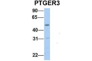 Host:  Rabbit  Target Name:  PTGER3  Sample Type:  Human Fetal Muscle  Antibody Dilution:  1. (PTGER3 anticorps  (C-Term))