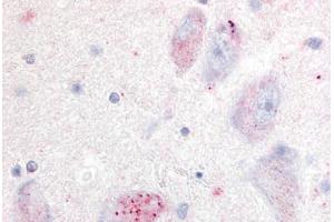 Human Basal Nucleus of Meynert (formalin-fixed, paraffin-embedded) stained with GPR20 antibody ABIN213332 at 20 ug/ml followed by biotinylated goat anti-rabbit IgG secondary antibody ABIN481713, alkaline phosphatase-streptavidin and chromogen.