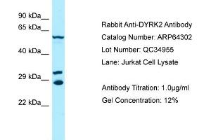 Western Blotting (WB) image for anti-Dual-Specificity tyrosine-(Y)-phosphorylation Regulated Kinase 2 (DYRK2) (C-Term) antibody (ABIN2789798)