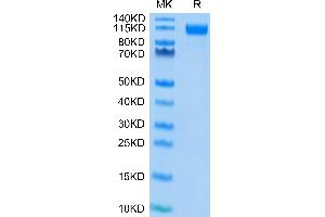 SDS-PAGE (SDS) image for SARS-CoV-2 Spike S1 (D614G) protein (His-Avi Tag) (ABIN7274404)