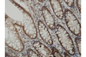 Immunoperoxidase of monoclonal antibody to CDK6 on formalin-fixed paraffin-embedded human colon.